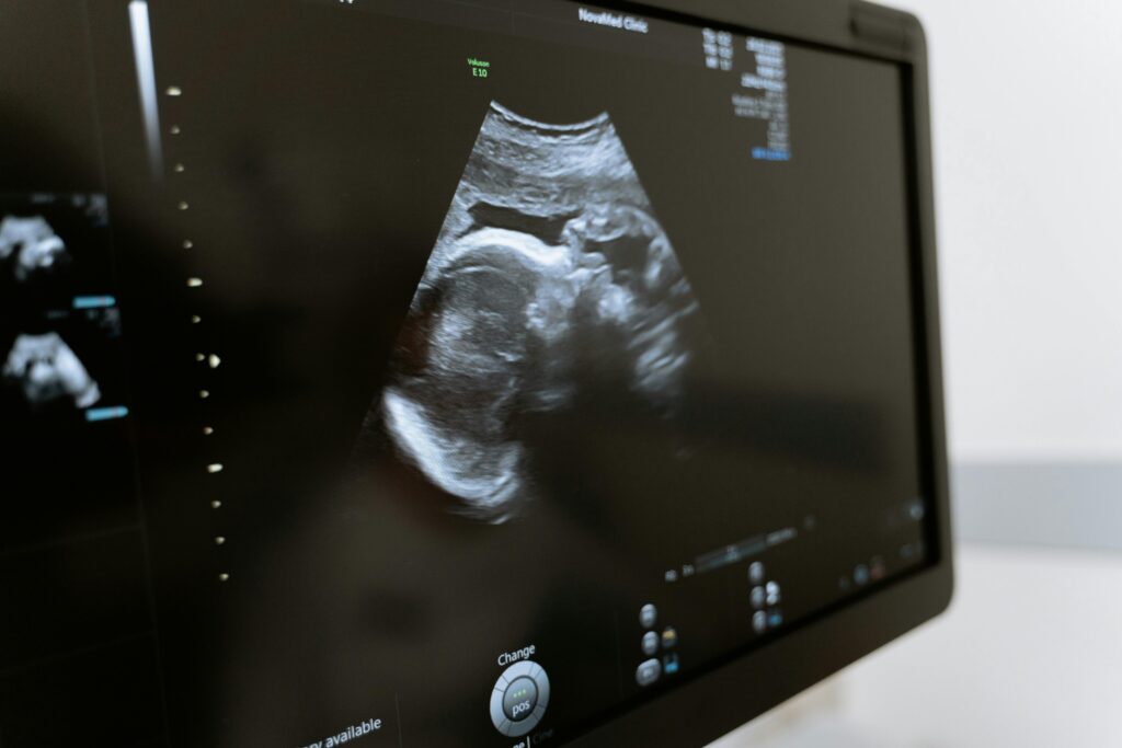 Close-up of an ultrasound showing a fetus on a monitor in a medical clinic.